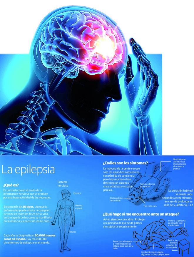 Epilepsy